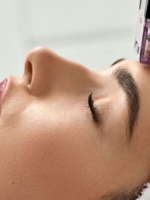 rf-microneedling-69307b108983e